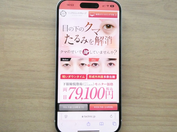 目の下のクマ・たるみ取りおすすめ:TAクリニック