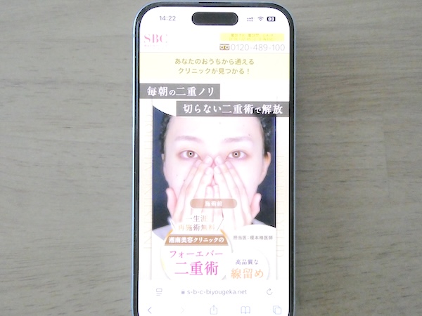二重整形・二重埋没おすすめ:湘南美容クリニック