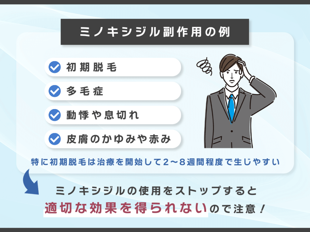 ミノキシジルの副作用で初期脱毛は事前に理解しておこう
